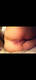 Anal